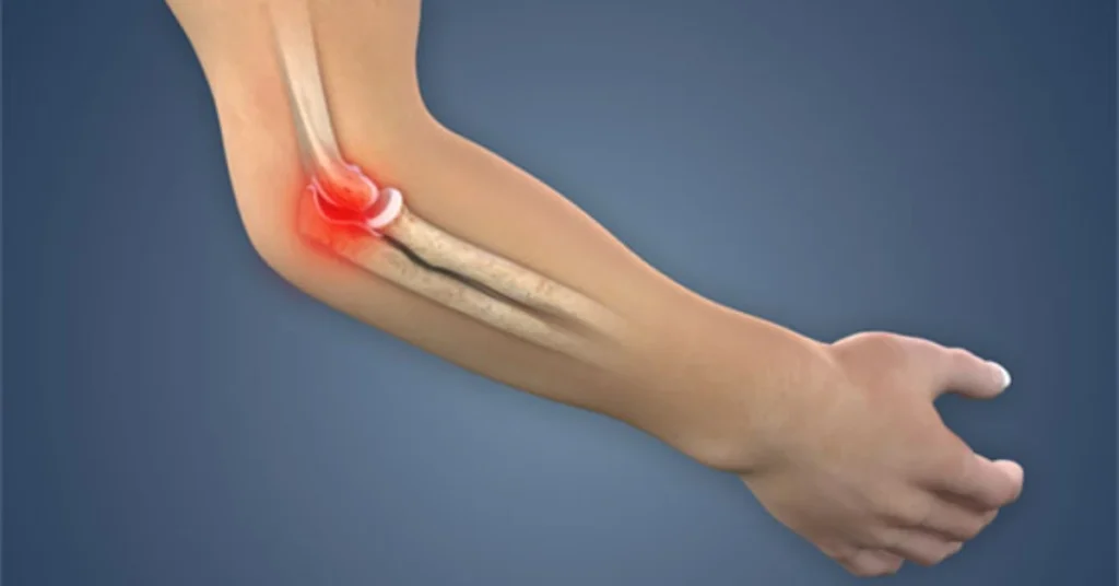 specific-right-elbow-symptoms-reveal