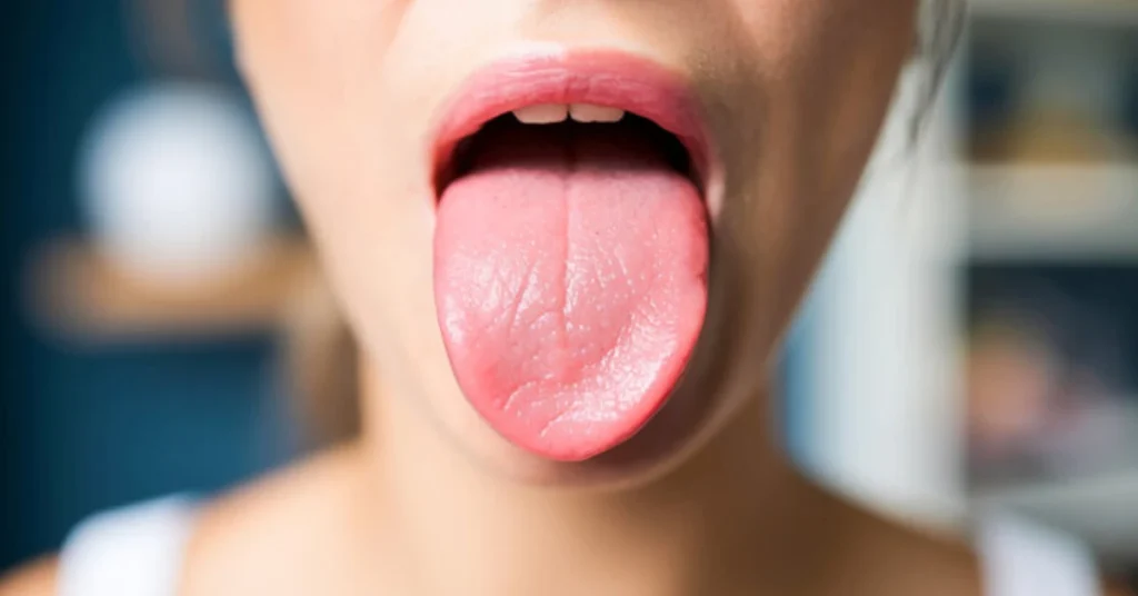 what-the-location-of-the-itch-tongue-reveals