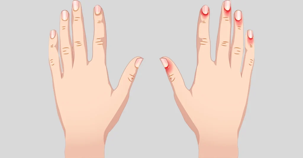 why-finger-itching-carries-spiritual-meaning