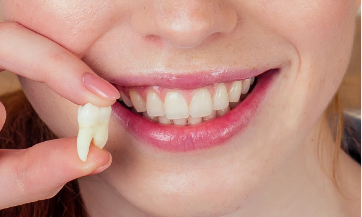 spiritual-meaning-of-wisdom-teeth